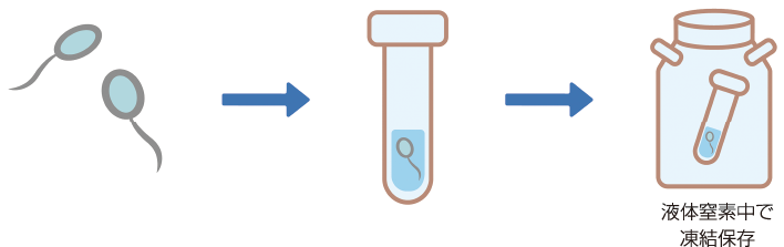 精子凍結保存の採取の方法：採取した精子を液体窒素中で冷凍保存